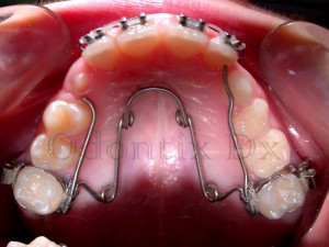 Orthodonthie
