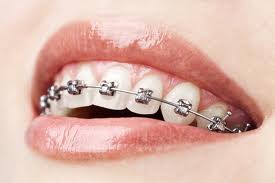 Orthodonthie